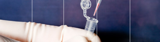 ISO17025 AABB Accredited DNA Testing Laboratory