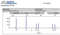 Example of an electropherogram